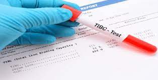 tibc-آزمایش-خون