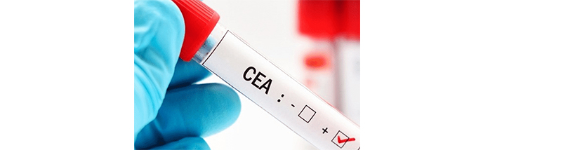 آزمایش--ceaیا--آنتی-ژن--carcinoembryonic-